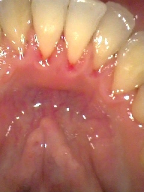 After